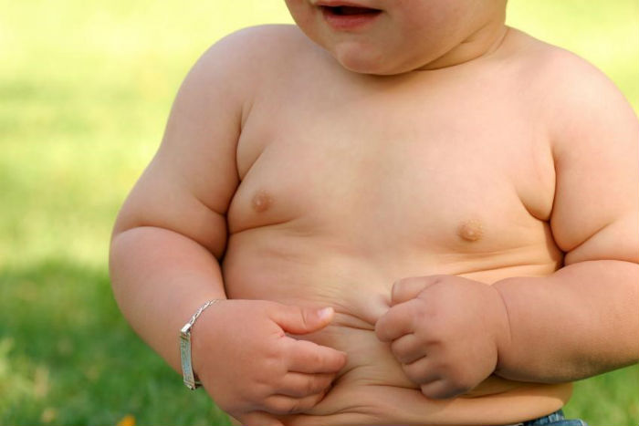 Anak Lahir Caesar Berisiko Obesitas