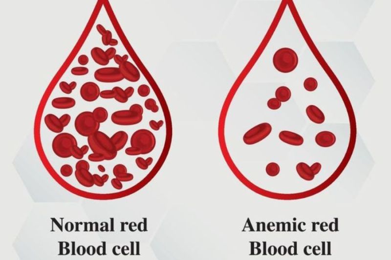 ilustrasi anemia