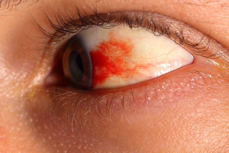 Jenis Penyakit Mata dan Cara Pencegahannya