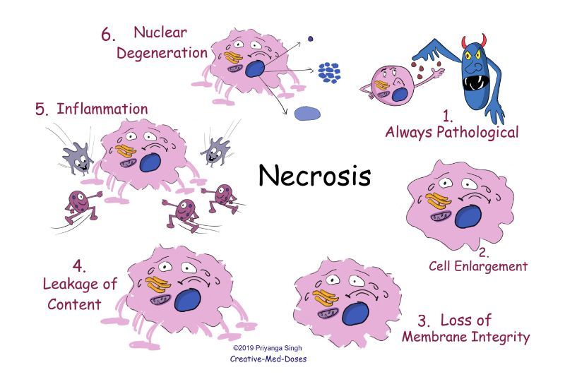 Pengertian Nekrosis