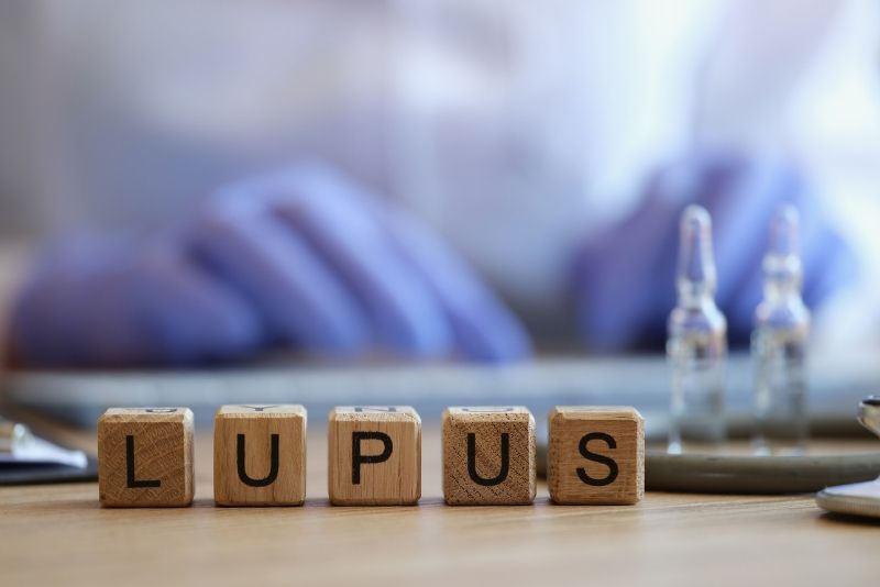 Penyakit Lupus