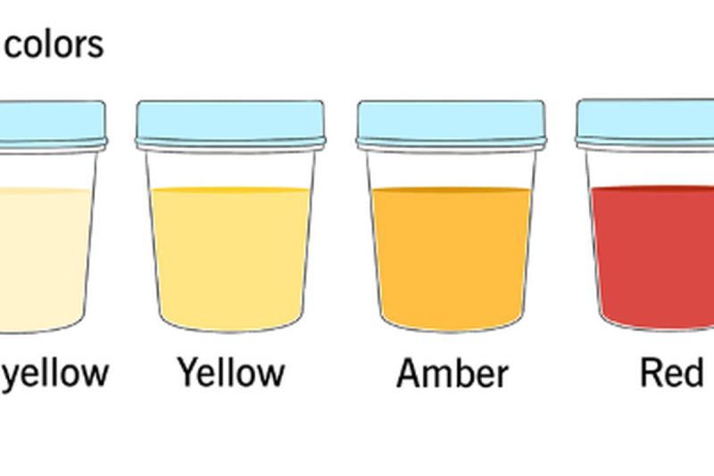 Urine bewarna kemerahan,(Cleveland Clinic)