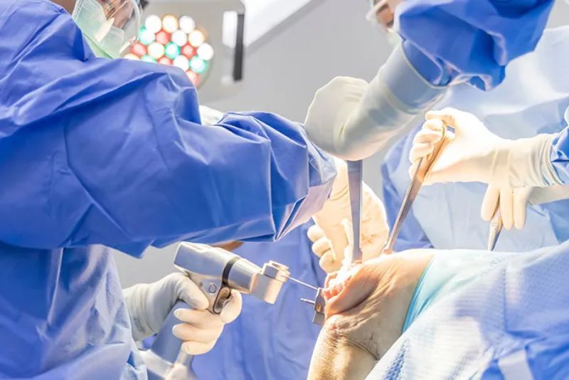 Menkes Usul Dokter Umum Diajarkan Bedah Sesar untuk Daerah Terpencil