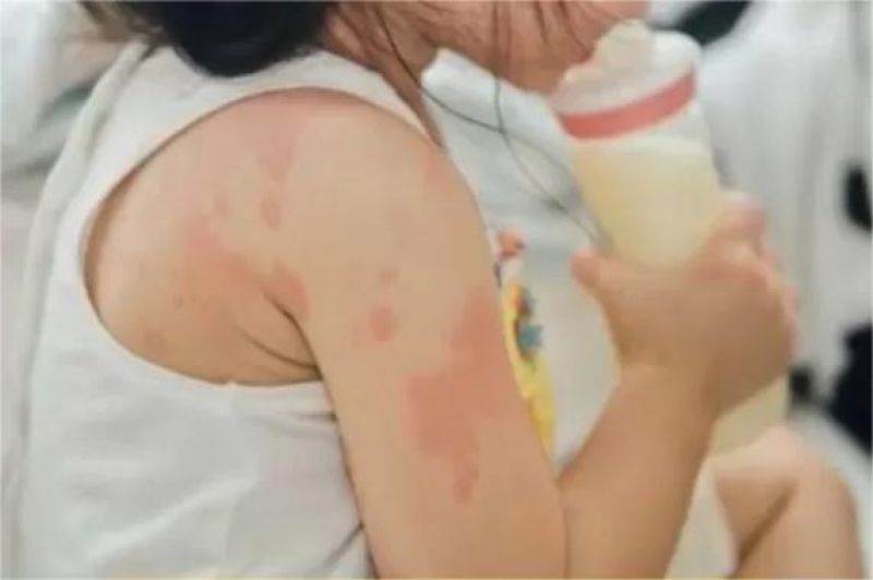 anak kecil sedang menolak makanan sambil menunjukkan wajah tidak nyaman, ilustrasi alergi makanan