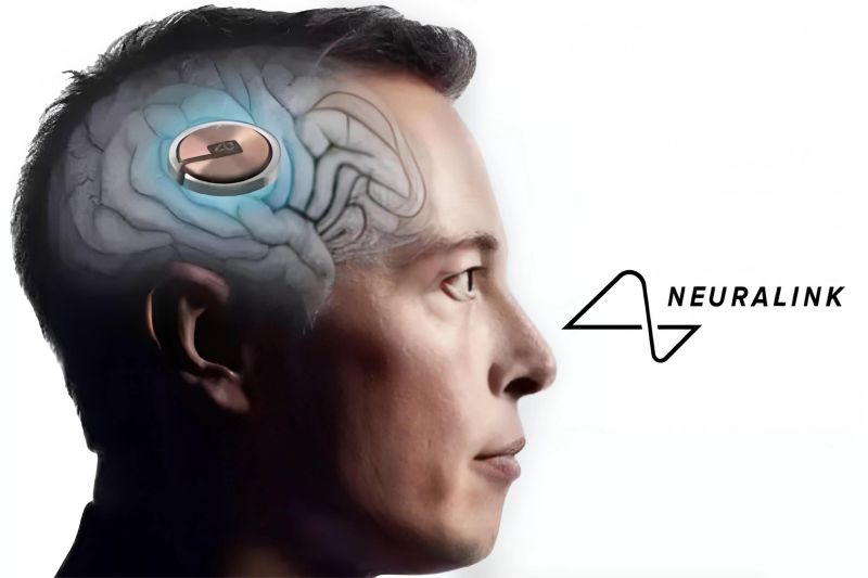 proses penanaman chip Neuralink ke otak manusia dalam ilustrasi teknologi futuristik