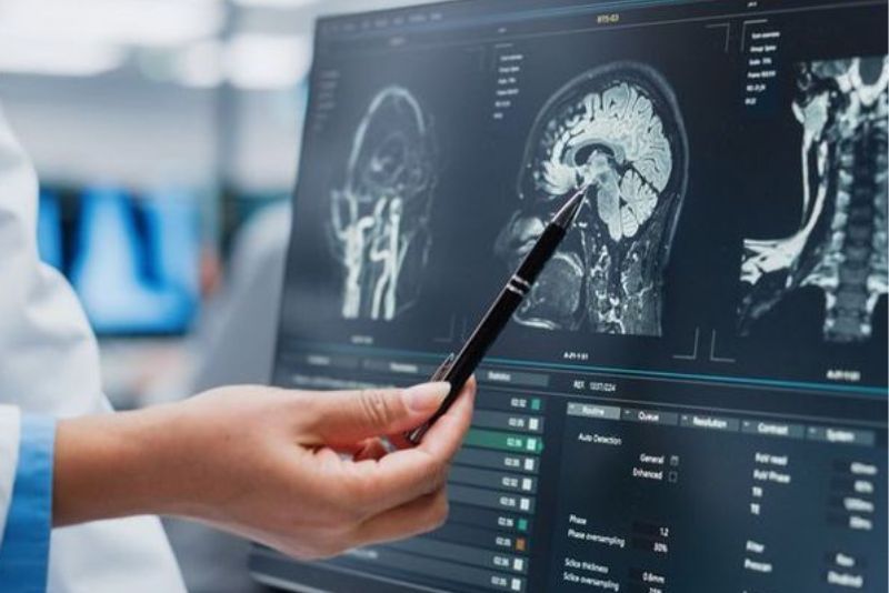 Kebiasaan Sehari-hari yang Berpotensi Memicu Tumor Otak, Waspadai!
