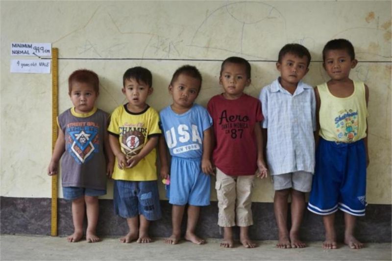 anak stunting indonesa