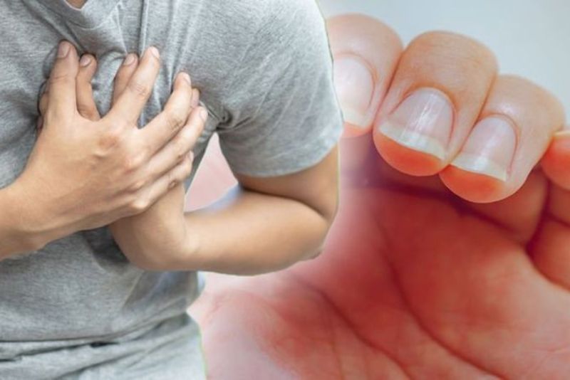 7 Ciri Kuku Orang dengan Masalah Jantung, Jangan Diabaikan!