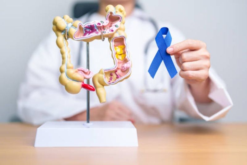 Misteri Kanker Usus Buntu pada Anak Muda: Mengapa Generasi Z dan Milenial Kini Jadi Korban?