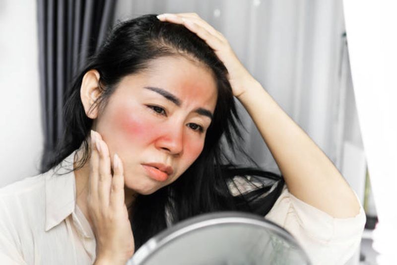 10 Gejala Lupus yang Sering Diabaikan: Waspadai Sebelum Terlambat!