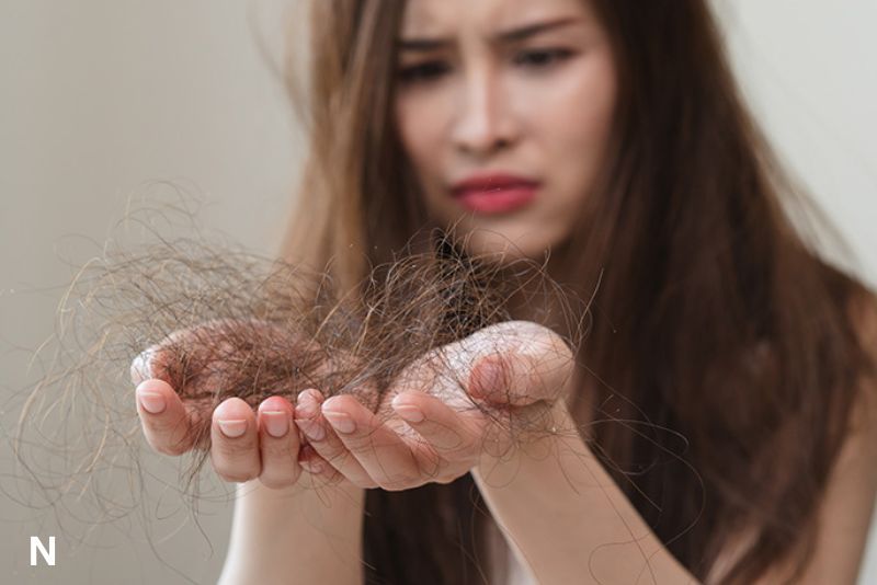 Kerontokan Rambut yang Harus Diwaspadai