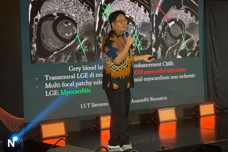 Distribusi MRI Indonesia