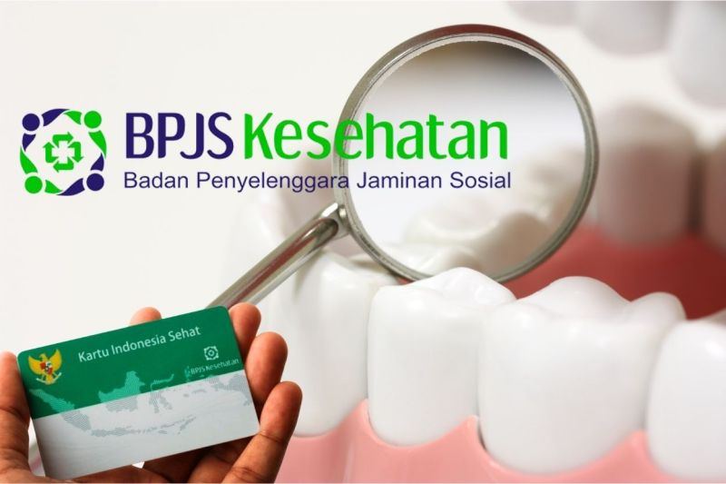 Jangan Lewatkan 7 Pelayanan Perawatan Gigi Unggulan Dokter Gigi BPJS Kesehatan Raih Senyum Sehatmu Sekarang