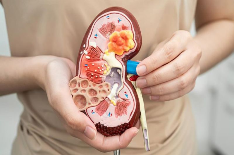 Kebiasan yang merusak Ginjal