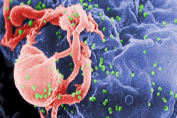 Ditemukan Gel Pencegah Infeksi HIV 