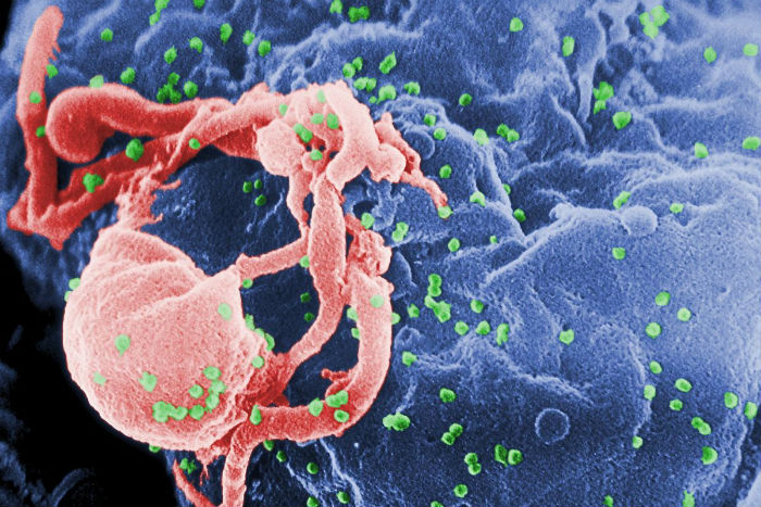Pengobatan Penyakit Autoimun Sebabkan HIV?