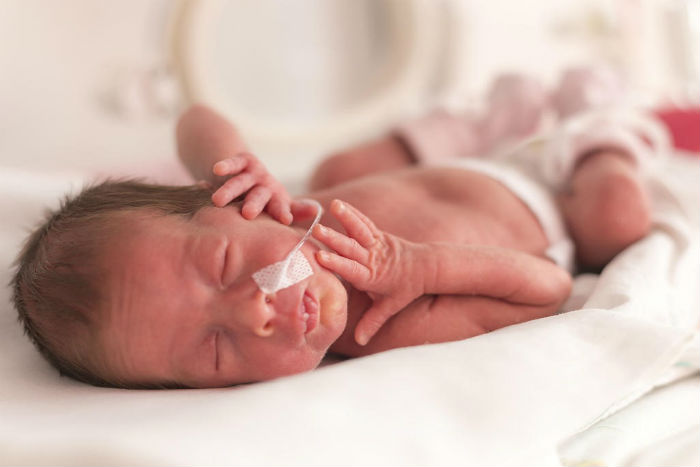 Penelitian pada Bayi Prematur Berikan Impilkasi untuk Perawatan di Masa Depan