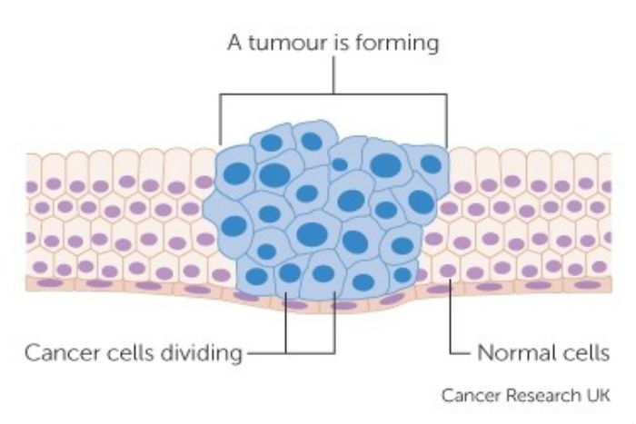 Bagaimana Sistem Imun Deteksi Sel Kanker