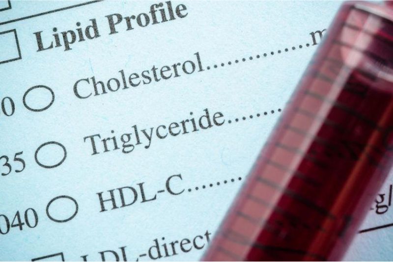 Apakah Trigliserida dan Kolesterol Sama? Berikut Penjelasannya...