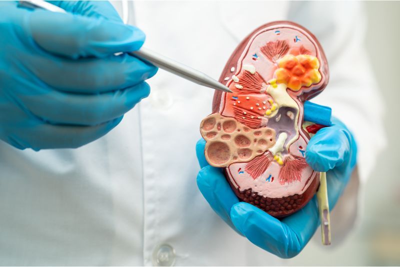Fungsi Organ Ginjal Manusia: Pentingnya Peran Ginjal dalam Tubuh Manusia