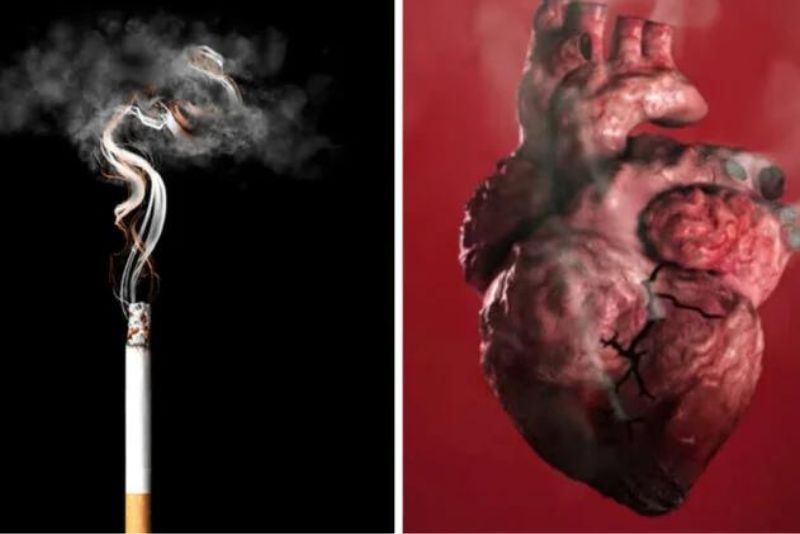 Dampak Buruk Merokok bagi Kesehatan