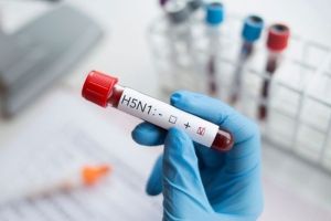 Kasus Penularan Flu Burung  dari Sapi ke Manusia Terkonfirmasi di Amerika Serikat