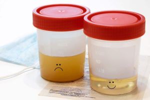 Urine: Penjelasan, Pengertian, dan Fungsi Pentingnya