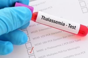 Bahaya Thalasemia: Penyakit Keturunan yang Bisa Bikin Gagal Nikah