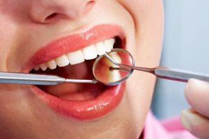 Tips Mudah Menjaga Kesehatan Gigi Anda