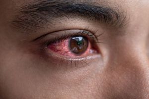 Mengenal Berbagai Jenis Penyakit Mata yang Umum Terjadi