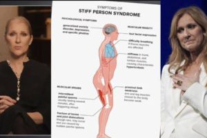 Celine Dion sempat didiagnosis menderita penyakit langka