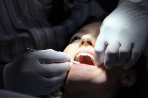 San Diego Cosmetic Dentist, Mengungkap Keindahan Senyum Bersama Dr. Safarian