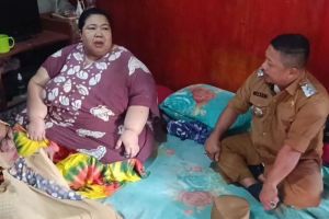 Wanita di Parepare Obesitas 200 Kg, Akui Bermula Seusai Vaksin Covid-19