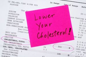Ilustrasi kolesterol(SHUTTERSTOCK)