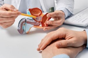Ilustrasi kanker prostat. Kanker prostat umum terjadi pada pria usia lanjut, tetapi bisa juga menyerang pada usia lebih muda. Ciri-cirinya bisa meliputi kencing berdarah.()