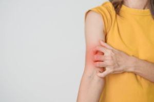 Ilustrasi lupus. Lupus adalah penyakit autoimun yang gejalanya sering samar, namun bisa dikendalikan dengan diagnosis dini dan pengobatan tepat.(Shutterstock/Jo Panuwat D)