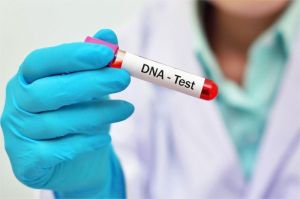 alat tes DNA dan laporan hasil pemeriksaan kesehatan berbasis genetik
