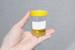 Warna dan Bau Urine Bisa Jadi Tanda Penyakit Serius, Apa Arti di Baliknya?