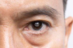 Mata Langka di Dunia: Apa Warna Mata yang Paling Jarang Ditemui?