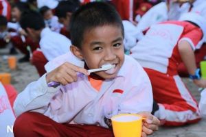 Ahli Ingatkan Pembatasan Makanan dan Minuman Demi Kesehatan Gigi