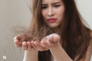 Kerontokan Rambut yang Harus Diwaspadai