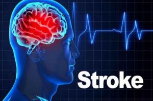 ilustrasi stroke