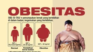 Langsing Bukan Sekadar Estetika: 9 Tips Cerdas Cegah Obesitas Sejak Dini