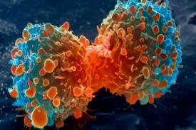 Para IlmuwanTemukan Cara untuk Menghentikan Kanker dengan Metastasis
