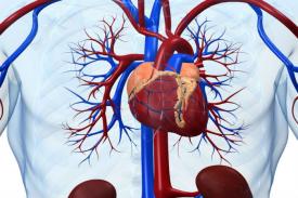 Pompa Jantung Magnetik Memotong Bekuan Darah, Risiko Stroke!
