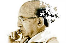 Studi Memberi Wawasan Baru Tentang Bagaimana Sel Otak Mati di Alzheimer
