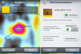 Aplikasi Smartphone Bisa Mendeteksi Penyakit Kanker