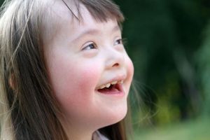 Hari Down Syndrome Sedunia 2024, Hilangkan Stereotipe