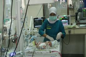 Rumah Sakit Hasan Sadikin Bandung Tangani Kembar Siam asal Padalarang