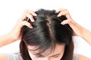 Bahan Alami Bantu Atasi Kulit Kepala Kering